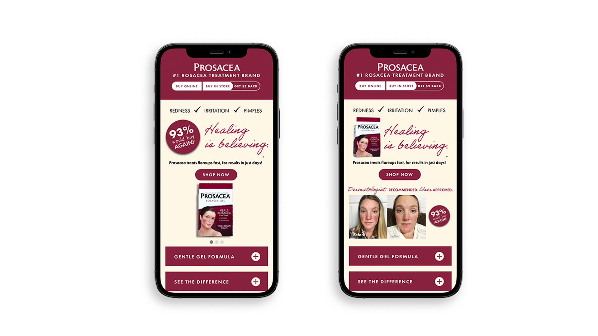 Alva Amco Pharmacal - digital campaign for prosacea - landing pages on mobile